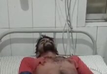 बारिश से बचने के लिए शेड में रुके ग्रामीणों पर गिरी आकाशीय बिजली, चार झुलसे , एक रेफर